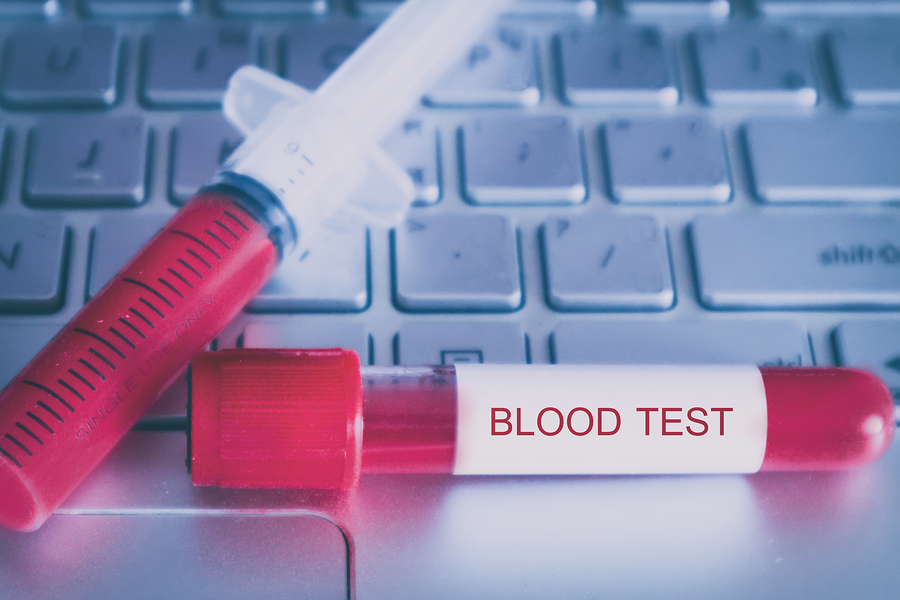 Какая ты кровь тест. Fit Blood Test. Выполнен анализ картинки. Тест на кровь на инструментах.